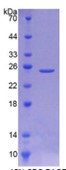 SDS-PAGE (Neu2-1189R).jpg